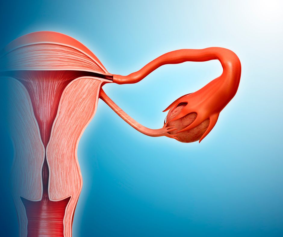 torsiunea ovariana